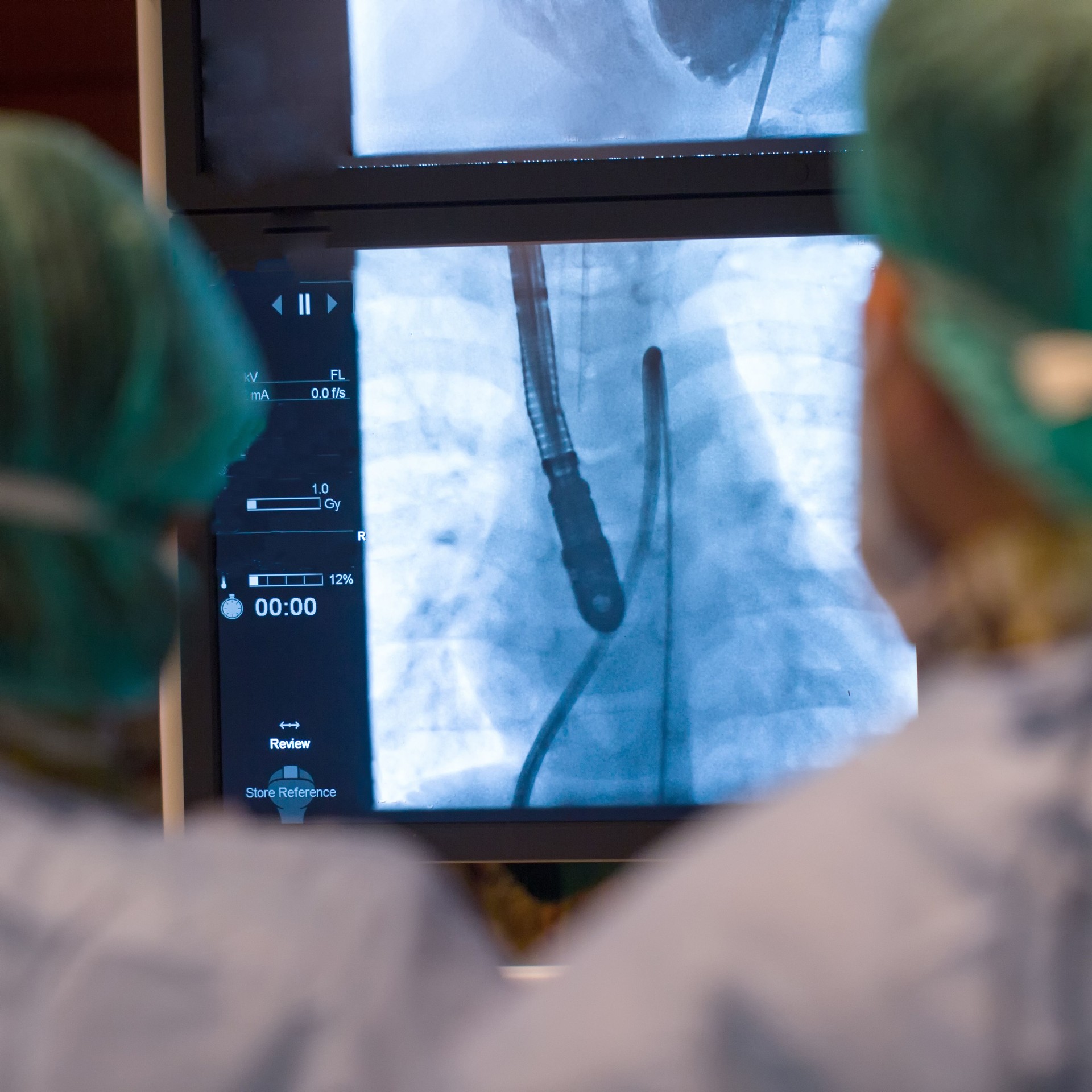 Xray monitor radio heart rate