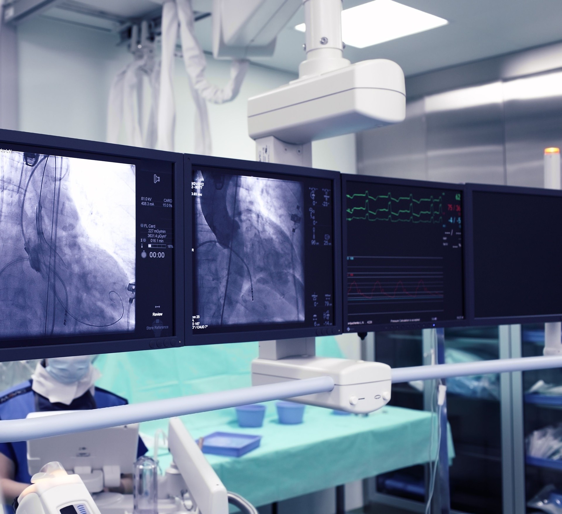 X Ray monitors in a hospital room
